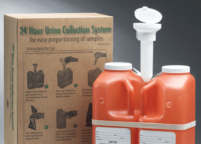 Standar operasional prosedur pengambilan sampel urine 24 jam